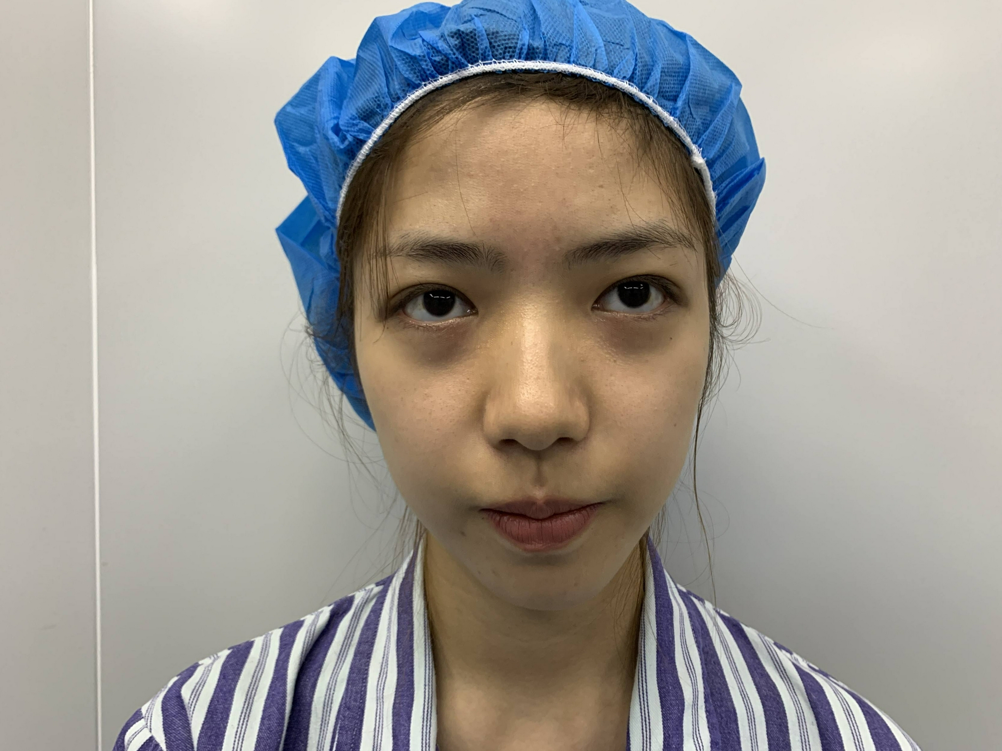 肝脏不好有哪些症状(怎样治疗)