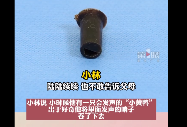 男子6岁吞哨子,怕被父母骂瞒了20年:千万别把孩子养成不敢和父母说话的人!休闲区蓝鸢梦想 - Www.slyday.coM 男子6岁吞哨子,怕被父母骂瞒了20年:千万别把孩子养成不敢和父母说话的人!休闲区蓝鸢梦想 - Www.slyday.coM