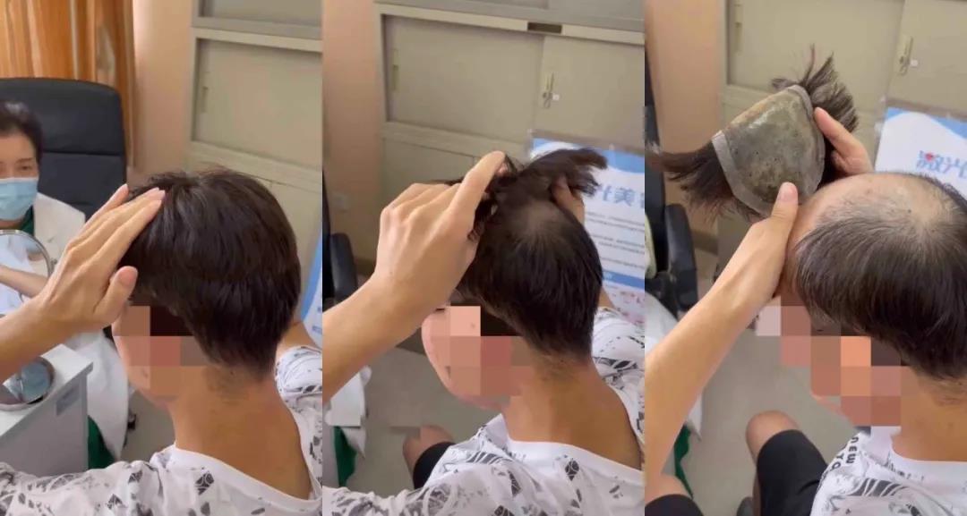 00后小伙头顶“寸草不生”,31岁白领脊髓变形......别再跟身体开玩笑了,你玩不过的!休闲区蓝鸢梦想 - Www.slyday.coM 00后小伙头顶“寸草不生”,31岁白领脊髓变形......别再跟身体开玩笑了,你玩不过的!休闲区蓝鸢梦想 - Www.slyday.coM