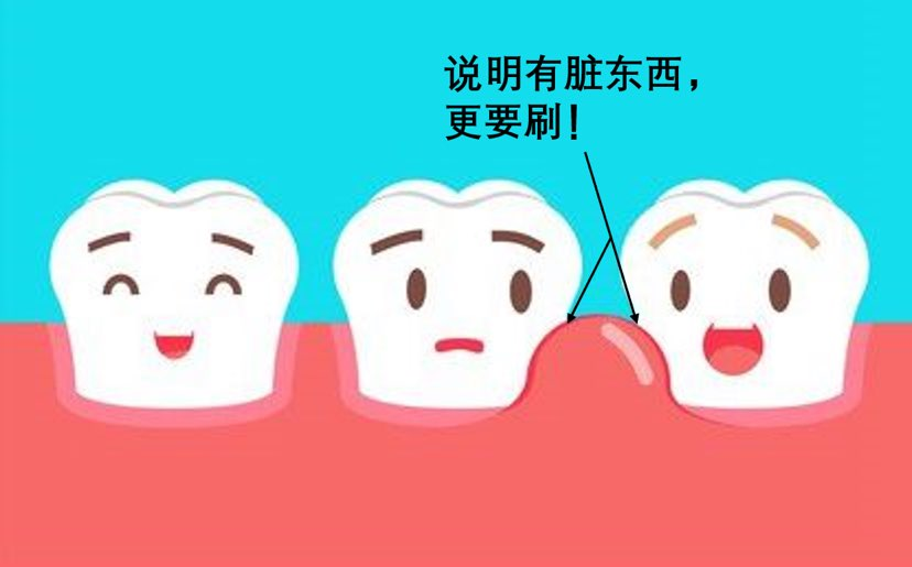 刷牙出血是怎么回事（刷牙老出血怎么办）-85模板网