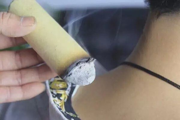 小孩鼻炎怎么办(儿童鼻炎怎样治疗才能彻底根治)