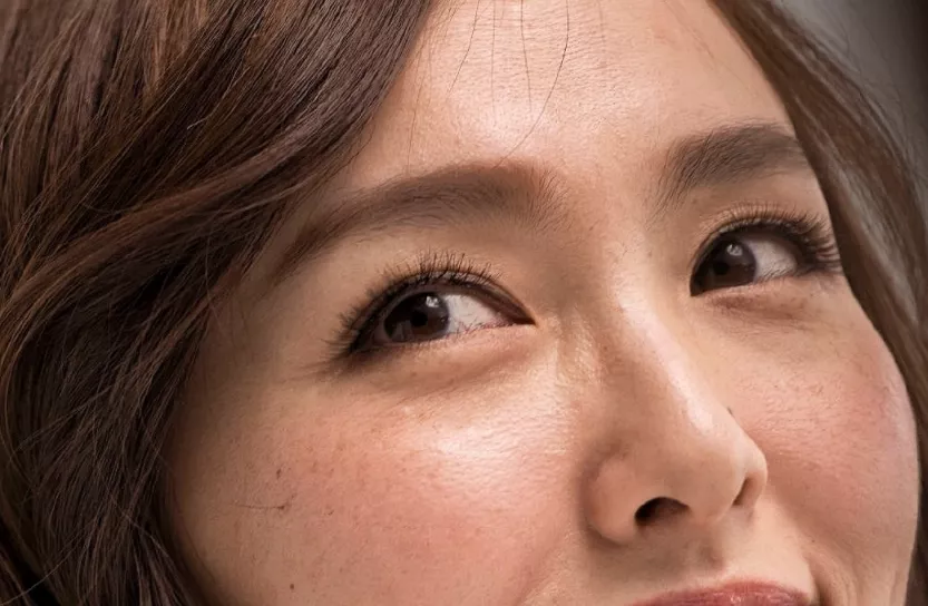 眼角鱼尾纹怎么办（眼角有鱼尾纹怎么消除）