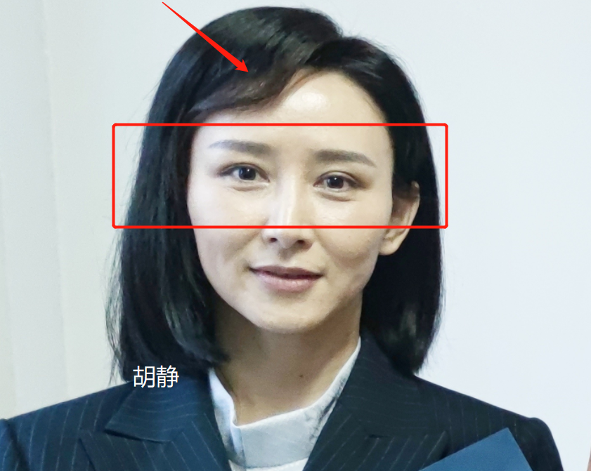 眼角鱼尾纹怎么办（眼角有鱼尾纹怎么消除）