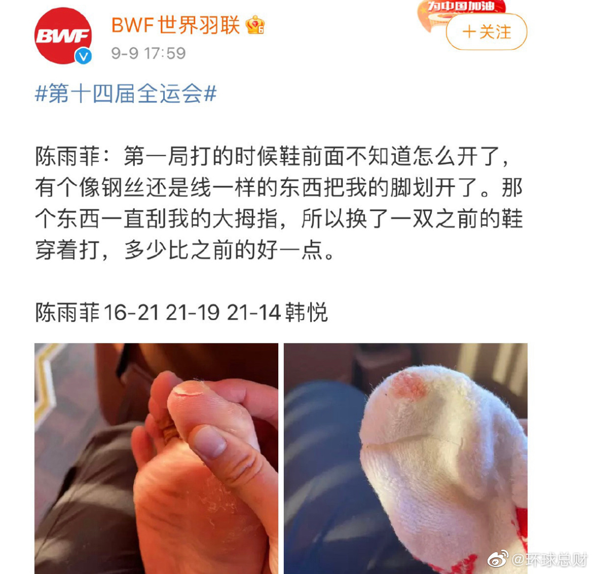 羽毛球奥运冠军陈雨菲被运动鞋割伤 李宁做出回应休闲区蓝鸢梦想 - Www.slyday.coM 羽毛球奥运冠军陈雨菲被运动鞋割伤 李宁做出回应休闲区蓝鸢梦想 - Www.slyday.coM