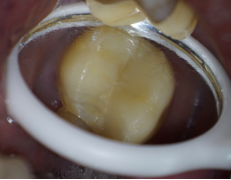 一口下去,7000元没了!这些脸型的人特别注意,每年这时候多发…...休闲区蓝鸢梦想 - Www.slyday.coM 一口下去,7000元没了!这些脸型的人特别注意,每年这时候多发…...休闲区蓝鸢梦想 - Www.slyday.coM