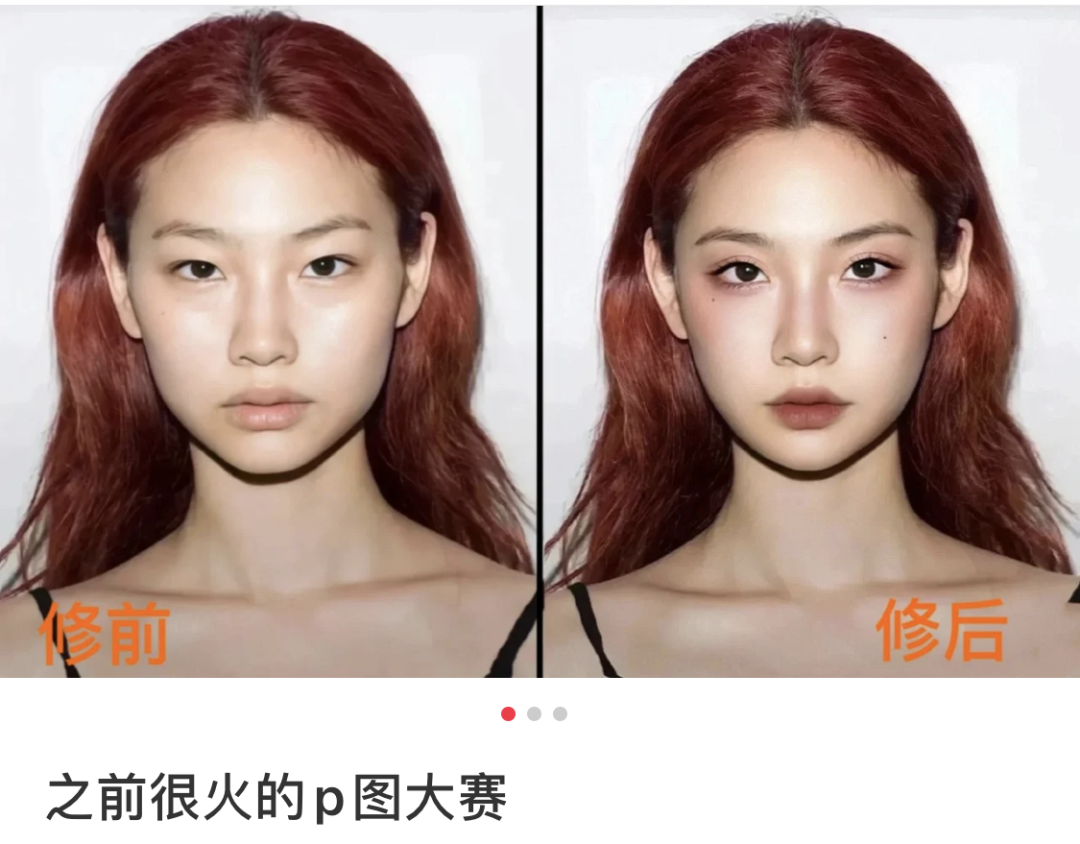 1年前丑到被全网求p图1年后吊打baby成整容模板竟然还和顶流谈恋爱了