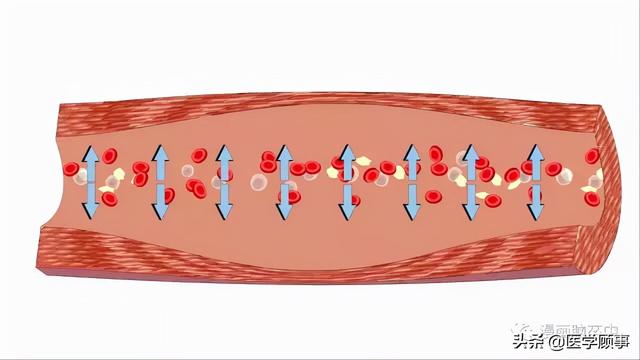 关于脑卒中,这是我看过的最清楚的科普休闲区蓝鸢梦想 - Www.slyday.coM 关于脑卒中,这是我看过的最清楚的科普休闲区蓝鸢梦想 - Www.slyday.coM
