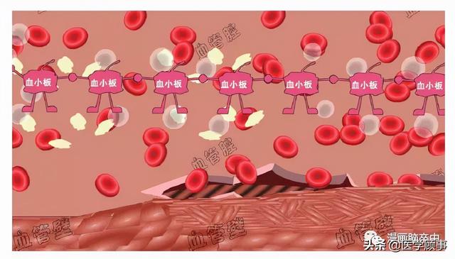关于脑卒中,这是我看过的最清楚的科普休闲区蓝鸢梦想 - Www.slyday.coM 关于脑卒中,这是我看过的最清楚的科普休闲区蓝鸢梦想 - Www.slyday.coM