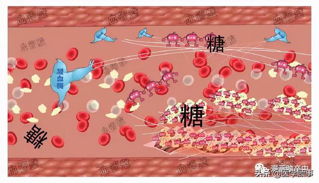 关于脑卒中,这是我看过的最清楚的科普休闲区蓝鸢梦想 - Www.slyday.coM 关于脑卒中,这是我看过的最清楚的科普休闲区蓝鸢梦想 - Www.slyday.coM