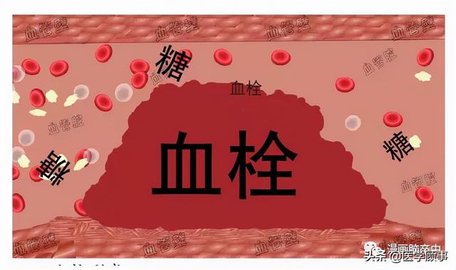 关于脑卒中,这是我看过的最清楚的科普休闲区蓝鸢梦想 - Www.slyday.coM 关于脑卒中,这是我看过的最清楚的科普休闲区蓝鸢梦想 - Www.slyday.coM