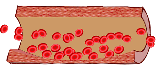 关于脑卒中,这是我看过的最清楚的科普休闲区蓝鸢梦想 - Www.slyday.coM 关于脑卒中,这是我看过的最清楚的科普休闲区蓝鸢梦想 - Www.slyday.coM