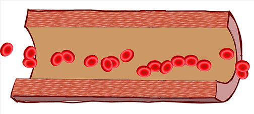 关于脑卒中,这是我看过的最清楚的科普休闲区蓝鸢梦想 - Www.slyday.coM 关于脑卒中,这是我看过的最清楚的科普休闲区蓝鸢梦想 - Www.slyday.coM