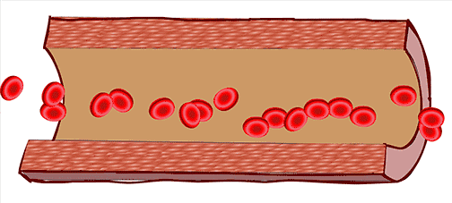 关于脑卒中,这是我看过的最清楚的科普休闲区蓝鸢梦想 - Www.slyday.coM 关于脑卒中,这是我看过的最清楚的科普休闲区蓝鸢梦想 - Www.slyday.coM