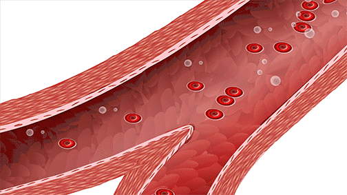 关于脑卒中,这是我看过的最清楚的科普休闲区蓝鸢梦想 - Www.slyday.coM 关于脑卒中,这是我看过的最清楚的科普休闲区蓝鸢梦想 - Www.slyday.coM