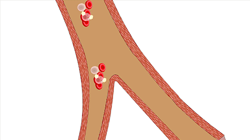 关于脑卒中,这是我看过的最清楚的科普休闲区蓝鸢梦想 - Www.slyday.coM 关于脑卒中,这是我看过的最清楚的科普休闲区蓝鸢梦想 - Www.slyday.coM