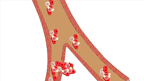 关于脑卒中,这是我看过的最清楚的科普休闲区蓝鸢梦想 - Www.slyday.coM 关于脑卒中,这是我看过的最清楚的科普休闲区蓝鸢梦想 - Www.slyday.coM