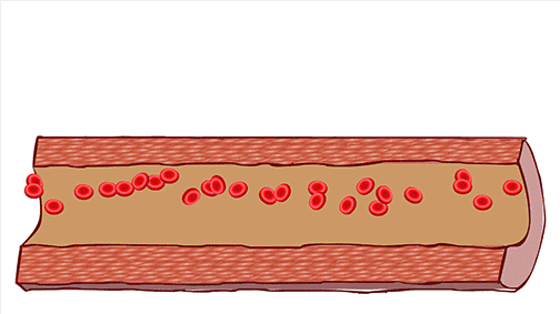 关于脑卒中,这是我看过的最清楚的科普休闲区蓝鸢梦想 - Www.slyday.coM 关于脑卒中,这是我看过的最清楚的科普休闲区蓝鸢梦想 - Www.slyday.coM