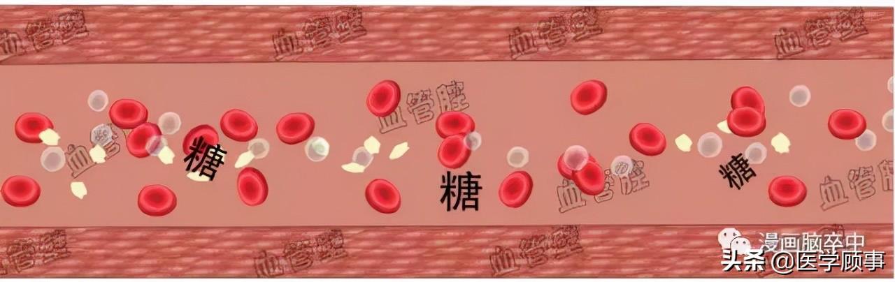 关于脑卒中,这是我看过的最清楚的科普休闲区蓝鸢梦想 - Www.slyday.coM 关于脑卒中,这是我看过的最清楚的科普休闲区蓝鸢梦想 - Www.slyday.coM