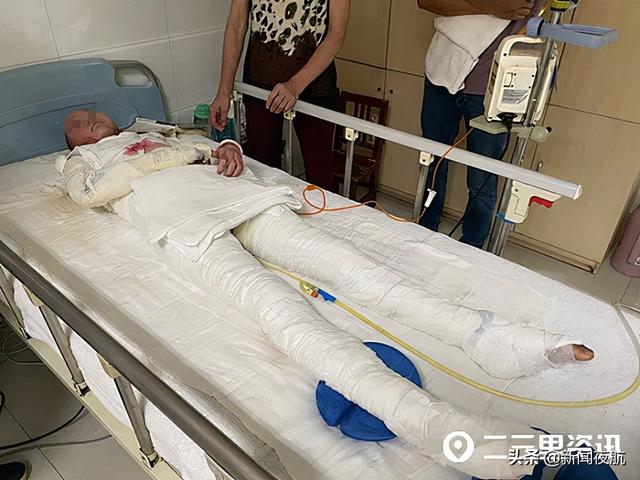 11岁女孩玩耍时引爆甲醇桶,全身90%被烧伤休闲区蓝鸢梦想 - Www.slyday.coM 11岁女孩玩耍时引爆甲醇桶,全身90%被烧伤休闲区蓝鸢梦想 - Www.slyday.coM