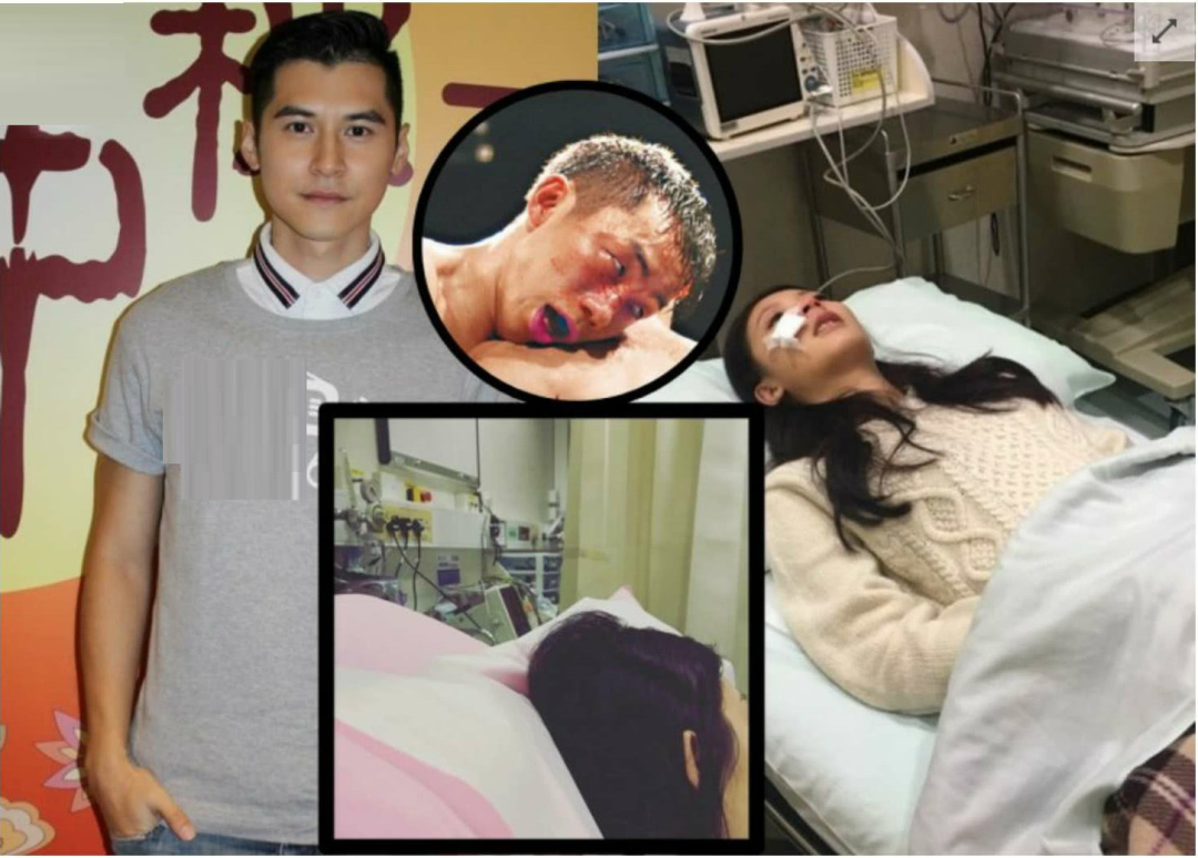 9位死里逃生的艺人：缝针、断肋骨、毁容，有人70岁了还丧子