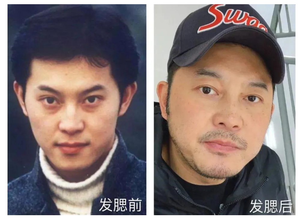 发腮比发福可怕！8位因发腮颜值暴跌的明星，对比堪比“毁容”