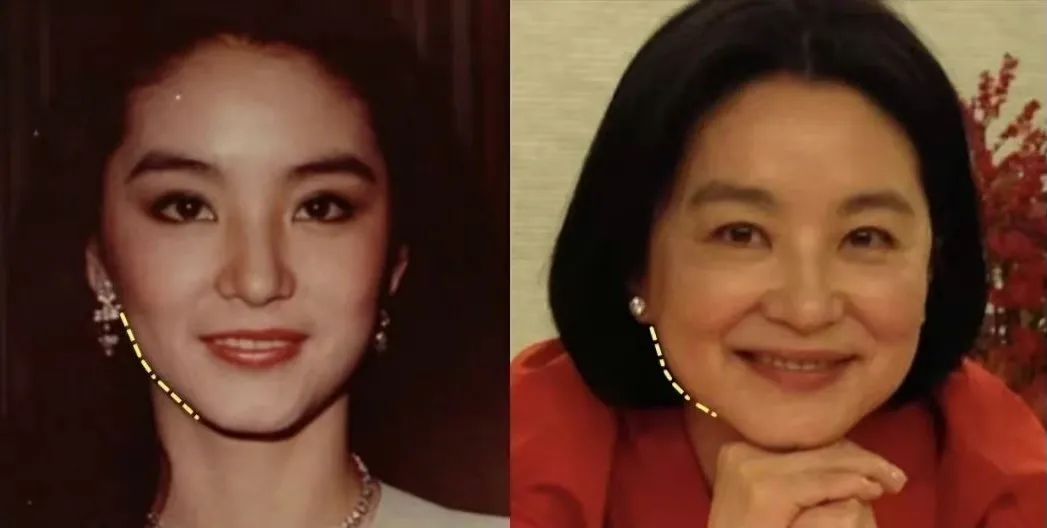 发腮比发福可怕！8位因发腮颜值暴跌的明星，对比堪比“毁容”