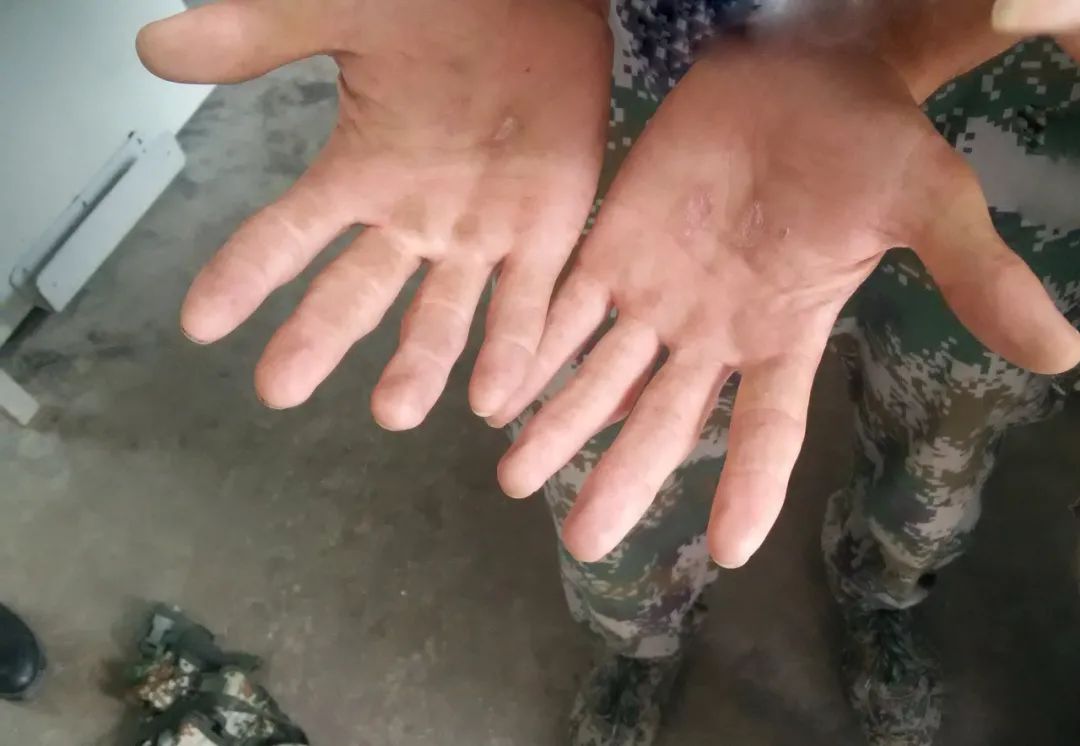 第一!00后大学生成特战女兵“神枪手”,双手让人心疼休闲区蓝鸢梦想 - Www.slyday.coM 第一!00后大学生成特战女兵“神枪手”,双手让人心疼休闲区蓝鸢梦想 - Www.slyday.coM