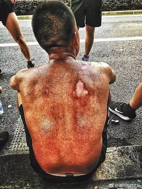 “119”不仅是电话号码,也是他们不普通的人生休闲区蓝鸢梦想 - Www.slyday.coM “119”不仅是电话号码,也是他们不普通的人生休闲区蓝鸢梦想 - Www.slyday.coM