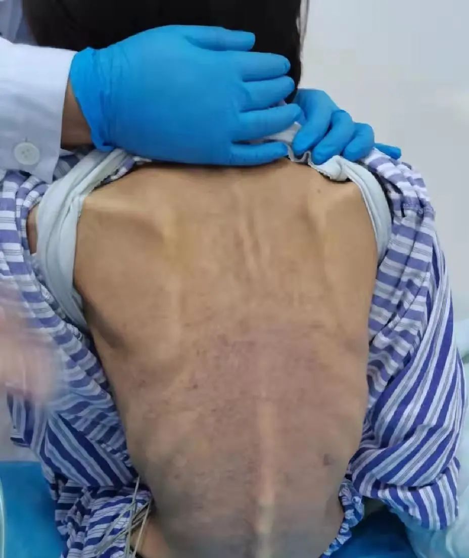 长沙00后女大学生疯狂减重到只剩60斤后昏厥,住院当天小便失禁了...休闲区蓝鸢梦想 - Www.slyday.coM 长沙00后女大学生疯狂减重到只剩60斤后昏厥,住院当天小便失禁了...休闲区蓝鸢梦想 - Www.slyday.coM