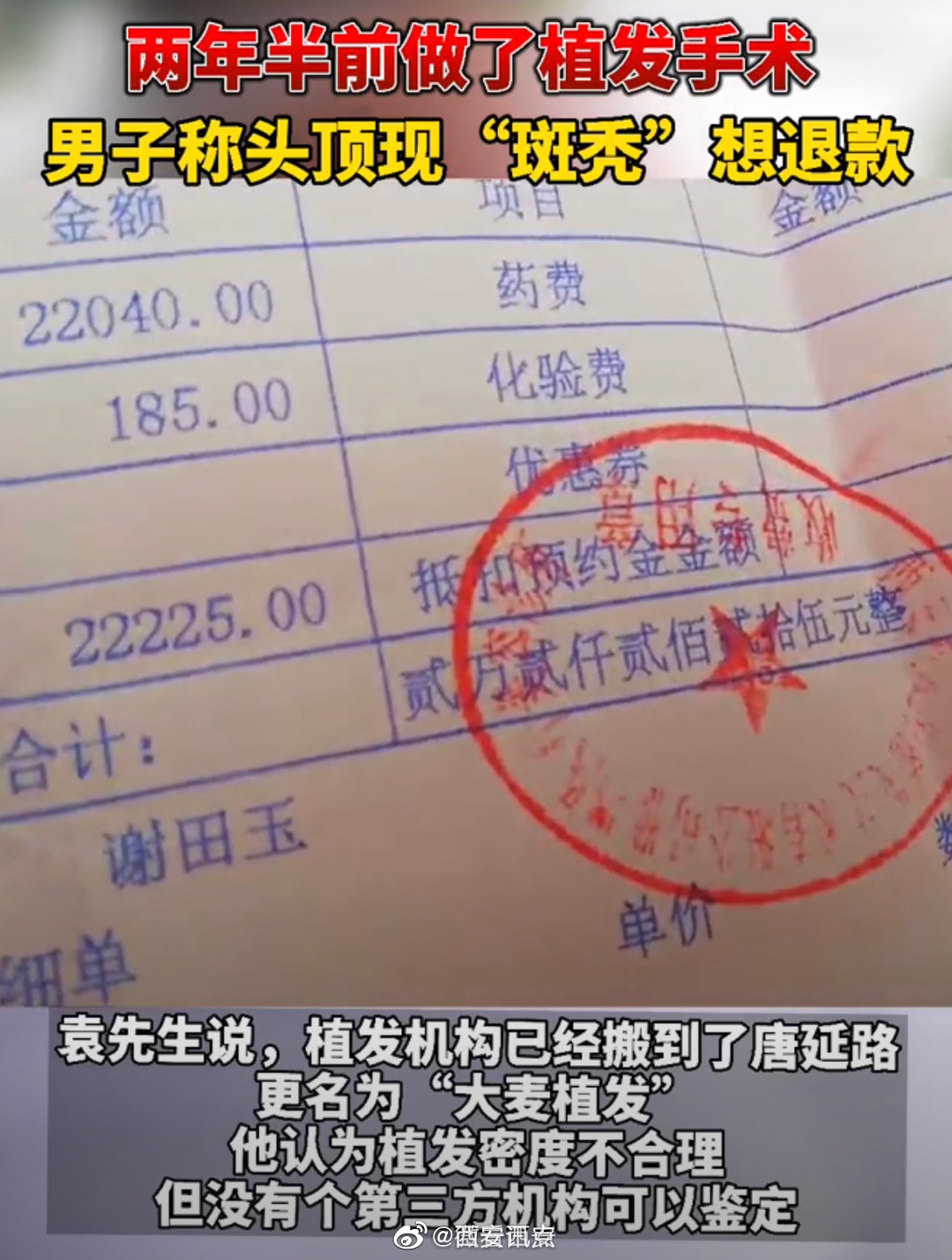 西安男子花4万元在大麦植发后斑秃 维权一年无结果(图2)