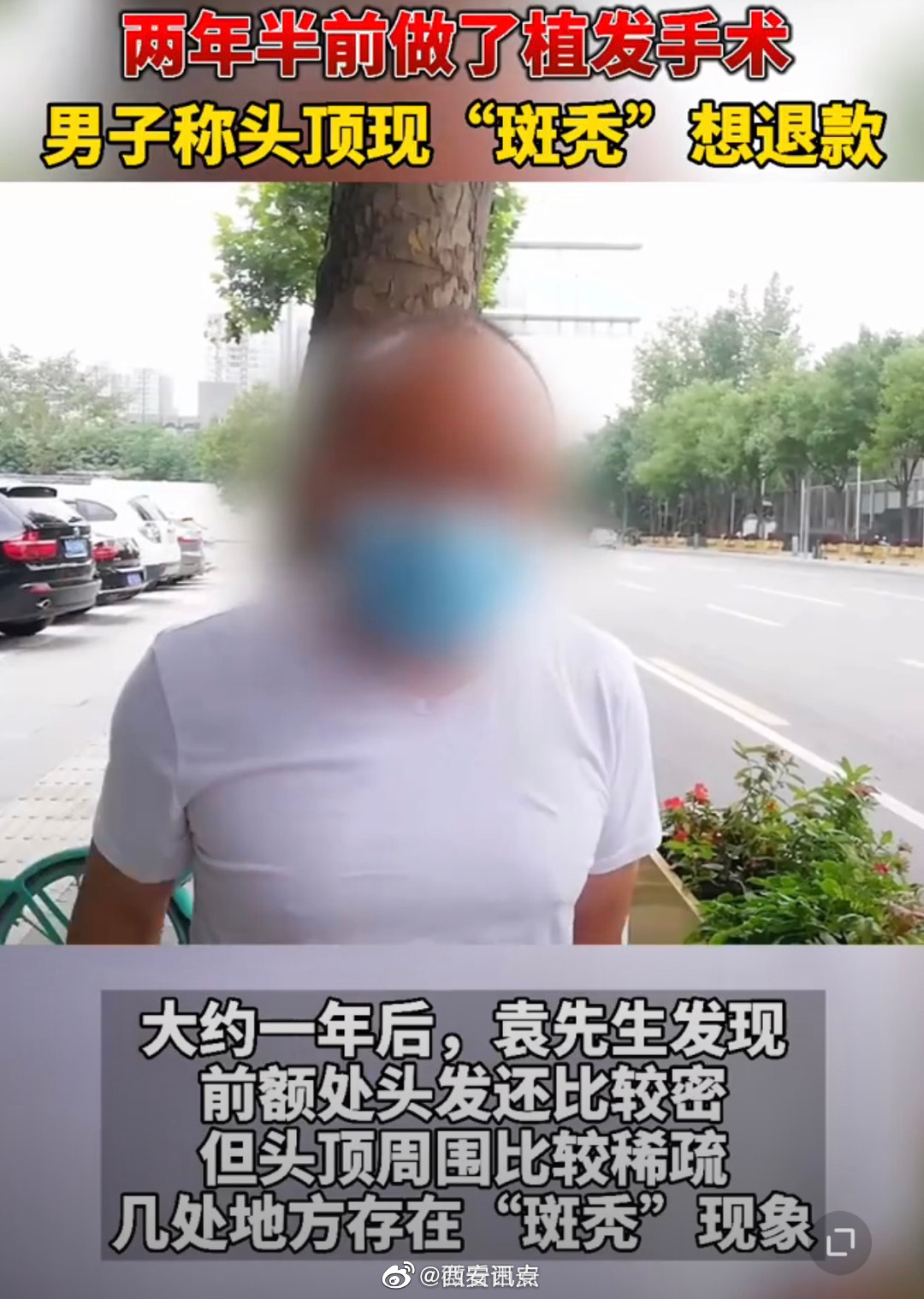 西安男子花4万元在大麦植发后斑秃 维权一年无结果(图3)