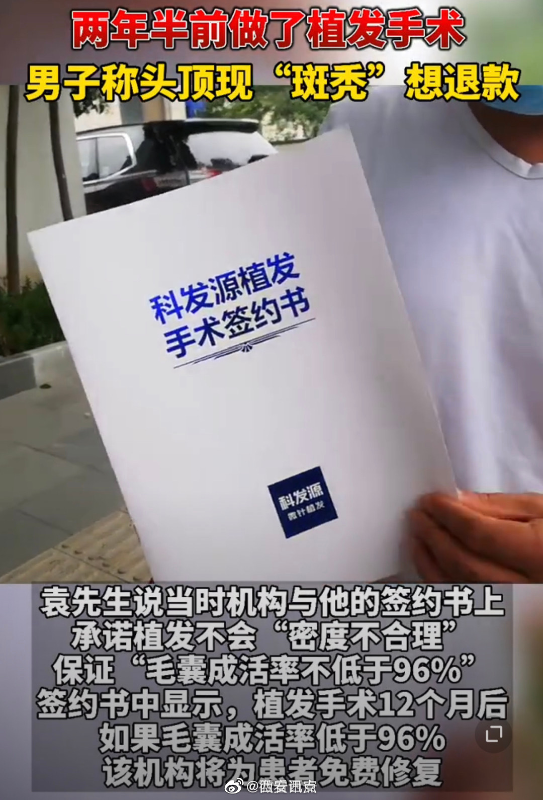 西安男子花4万元在大麦植发后斑秃 维权一年无结果(图1)