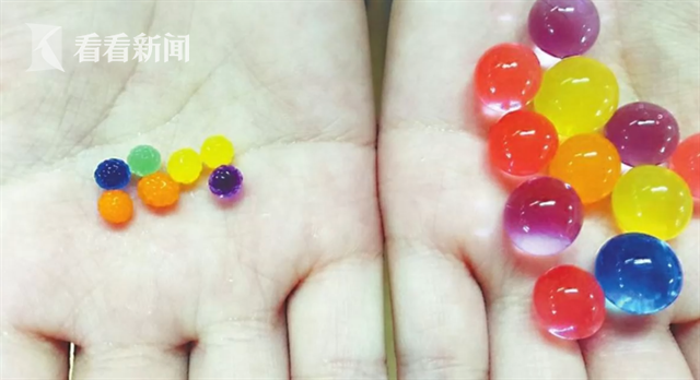 1岁女童误把网红玩具当糖吞下 医生紧急手术取出休闲区蓝鸢梦想 - Www.slyday.coM 1岁女童误把网红玩具当糖吞下 医生紧急手术取出休闲区蓝鸢梦想 - Www.slyday.coM