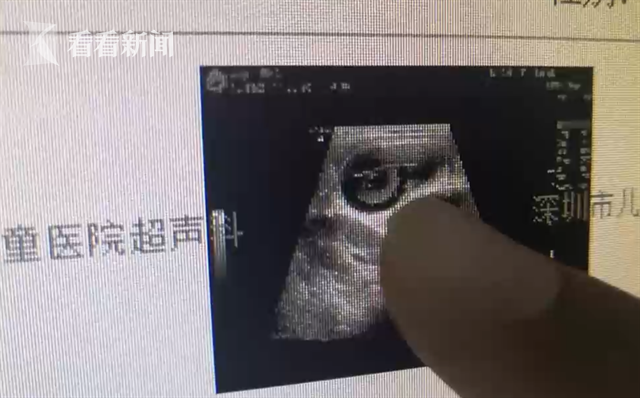 1岁女童误把网红玩具当糖吞下 医生紧急手术取出休闲区蓝鸢梦想 - Www.slyday.coM 1岁女童误把网红玩具当糖吞下 医生紧急手术取出休闲区蓝鸢梦想 - Www.slyday.coM