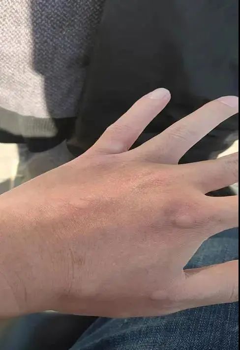 缉毒行动中,他被剧毒“红火蚁”咬伤!剧痛下三次倒地,仍爬起紧追!休闲区蓝鸢梦想 - Www.slyday.coM 缉毒行动中,他被剧毒“红火蚁”咬伤!剧痛下三次倒地,仍爬起紧追!休闲区蓝鸢梦想 - Www.slyday.coM