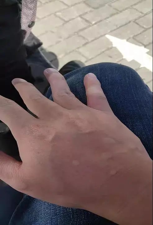 缉毒行动中,他被剧毒“红火蚁”咬伤!剧痛下三次倒地,仍爬起紧追!休闲区蓝鸢梦想 - Www.slyday.coM 缉毒行动中,他被剧毒“红火蚁”咬伤!剧痛下三次倒地,仍爬起紧追!休闲区蓝鸢梦想 - Www.slyday.coM