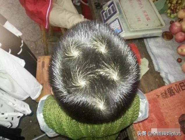 孩子头顶几个旋究竟代表什么不懂的家长快来对照下