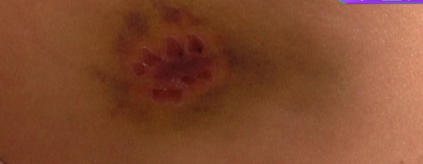 新华社五问安阳狗咬人事件 河南安阳狗咬老人后续始末!河南安阳狗咬老人处理结果最新消息休闲区蓝鸢梦想 - Www.slyday.coM 新华社五问安阳狗咬人事件 河南安阳狗咬老人后续始末!河南安阳狗咬老人处理结果最新消息休闲区蓝鸢梦想 - Www.slyday.coM