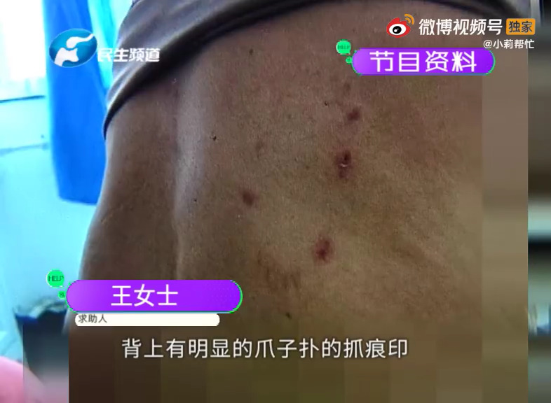 新华社五问安阳狗咬人事件 河南安阳狗咬老人后续始末!河南安阳狗咬老人处理结果最新消息休闲区蓝鸢梦想 - Www.slyday.coM 新华社五问安阳狗咬人事件 河南安阳狗咬老人后续始末!河南安阳狗咬老人处理结果最新消息休闲区蓝鸢梦想 - Www.slyday.coM