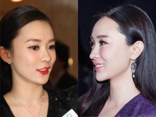 俞飞鸿皮肤紧致,郝蕾、袁立面部浮肿,下颚线对颜值的影响有多大休闲区蓝鸢梦想 - Www.slyday.coM 俞飞鸿皮肤紧致,郝蕾、袁立面部浮肿,下颚线对颜值的影响有多大休闲区蓝鸢梦想 - Www.slyday.coM