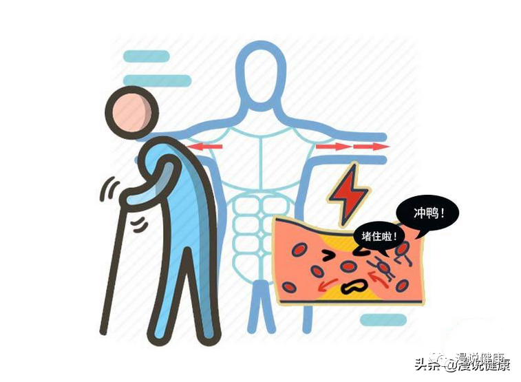 6个血栓患者有5个原本可避免?日常做好4件事,预防血栓通血管休闲区蓝鸢梦想 - Www.slyday.coM 6个血栓患者有5个原本可避免?日常做好4件事,预防血栓通血管休闲区蓝鸢梦想 - Www.slyday.coM