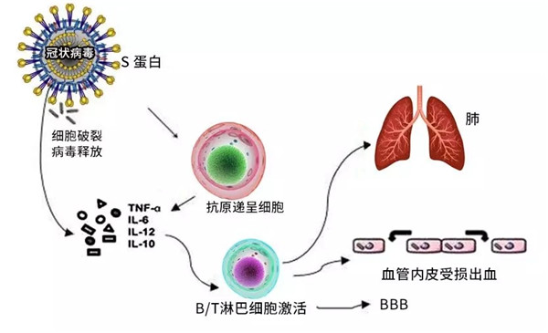 冠状病毒入侵机体的免疫过程及造成的机体损伤,图片来源丁香园修改