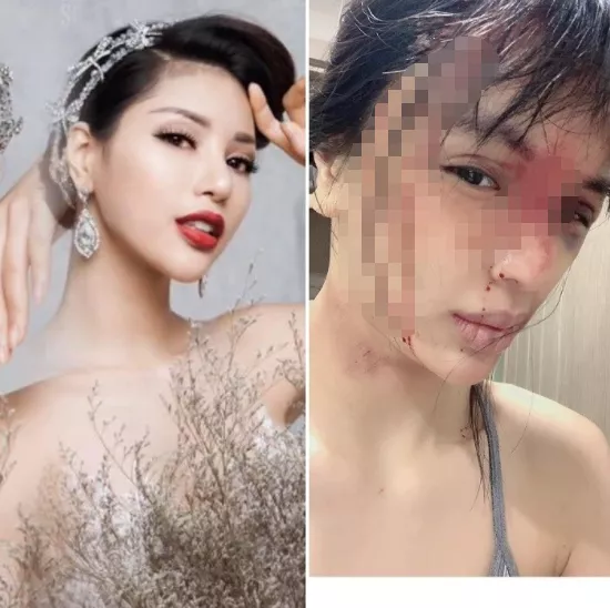 越南超模被爆遭家暴,孕期被丈夫殴打,还把她的头按进马桶里