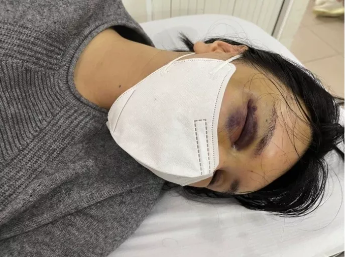 越南超模被爆遭家暴，孕期被丈夫殴打，还把她的头按进马桶里