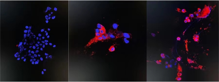 免疫荧光图像检测变种病毒的NP蛋白，未感染组 （左）和48小时感染组（中、右） 图片来自央视新闻