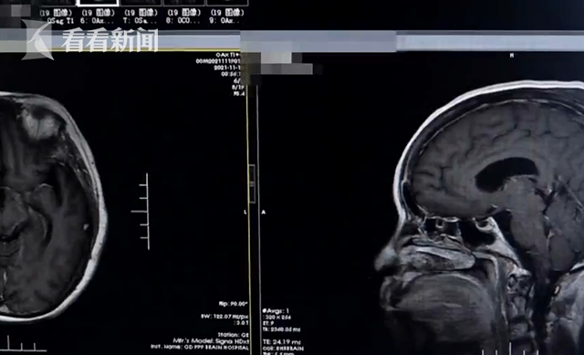 警惕!吃了冰箱里一碗饭 女子持续发高烧险丧命休闲区蓝鸢梦想 - Www.slyday.coM 警惕!吃了冰箱里一碗饭 女子持续发高烧险丧命休闲区蓝鸢梦想 - Www.slyday.coM