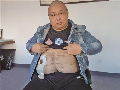 成为“南京胖哥”后的日子:因见义勇为被捅伤 他说不后悔休闲区蓝鸢梦想 - Www.slyday.coM 成为“南京胖哥”后的日子:因见义勇为被捅伤 他说不后悔休闲区蓝鸢梦想 - Www.slyday.coM