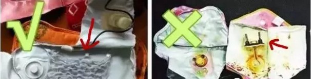 1岁男童睡电热毯时尿床被烧伤!这些取暖神器用不对秒变危险利器休闲区蓝鸢梦想 - Www.slyday.coM 1岁男童睡电热毯时尿床被烧伤!这些取暖神器用不对秒变危险利器休闲区蓝鸢梦想 - Www.slyday.coM