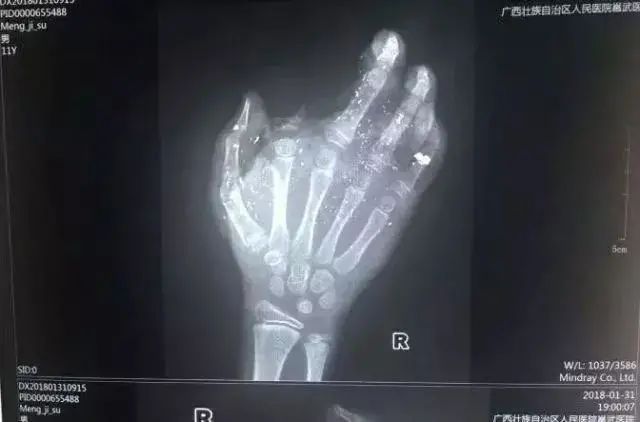 自燃瞬间烧毁整间房!这样的充电数据线千万别用了……休闲区蓝鸢梦想 - Www.slyday.coM 自燃瞬间烧毁整间房!这样的充电数据线千万别用了……休闲区蓝鸢梦想 - Www.slyday.coM