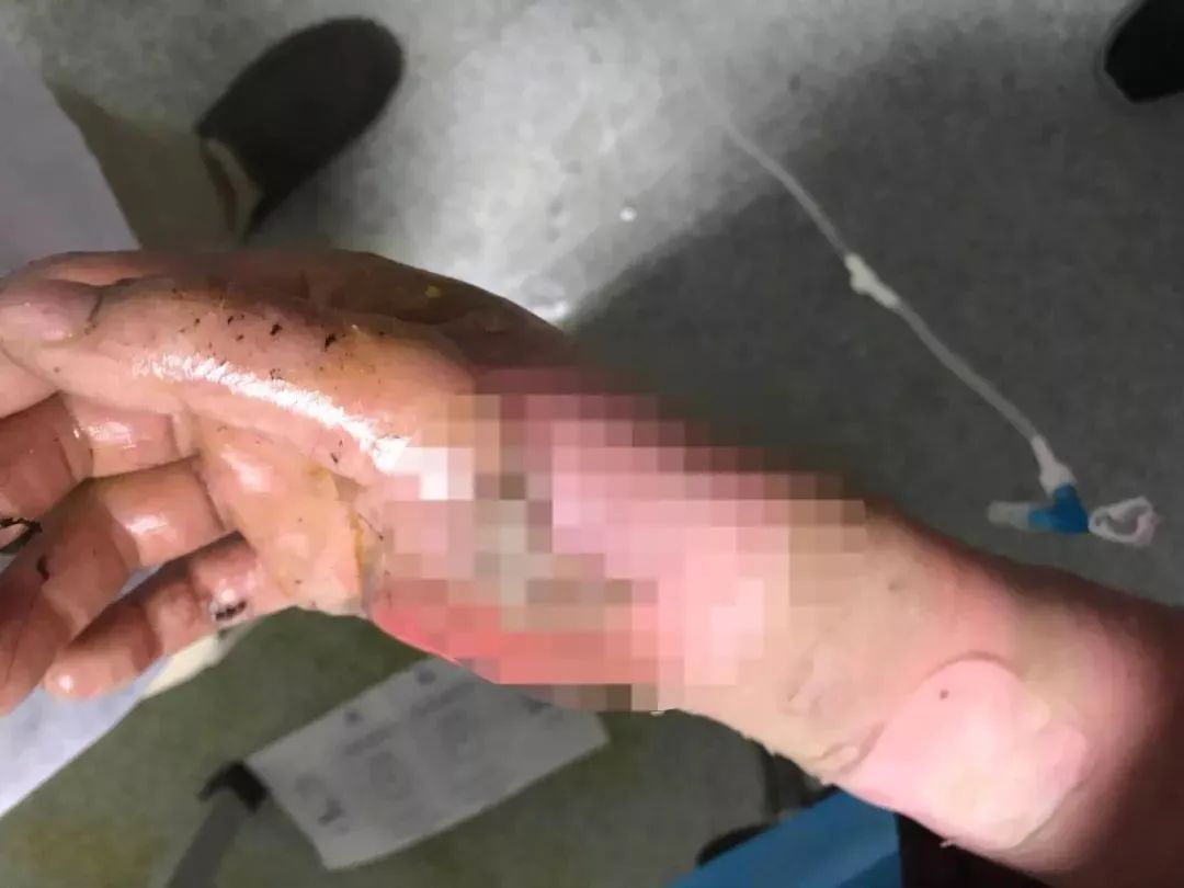 自燃瞬间烧毁整间房!这样的充电数据线千万别用了……休闲区蓝鸢梦想 - Www.slyday.coM 自燃瞬间烧毁整间房!这样的充电数据线千万别用了……休闲区蓝鸢梦想 - Www.slyday.coM